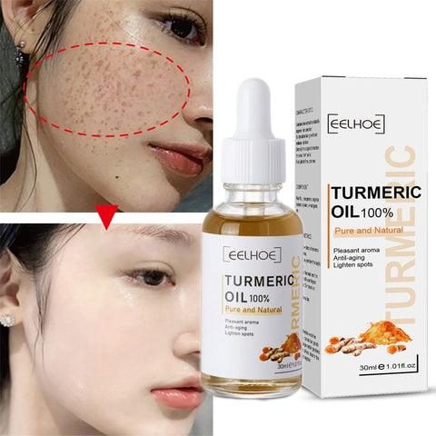 Turmeric Freckle Whitening Serum Curcumin Oil Brighten Fade Dark Spot Removal Pigment Melanin Correcting Beauty Face Skin Care