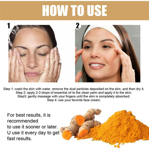 Turmeric Freckle Whitening Serum Curcumin Oil Brighten Fade Dark Spot Removal Pigment Melanin Correcting Beauty Face Skin Care